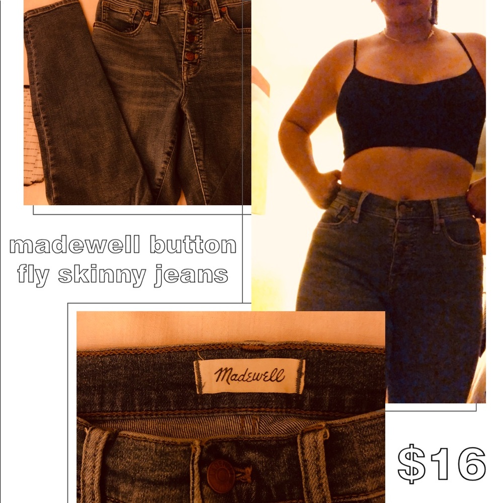 Madewell Button Fly High-Rise Jeans